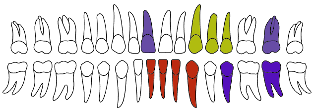 4Dental Lab interactive tooth chart with selected treatments